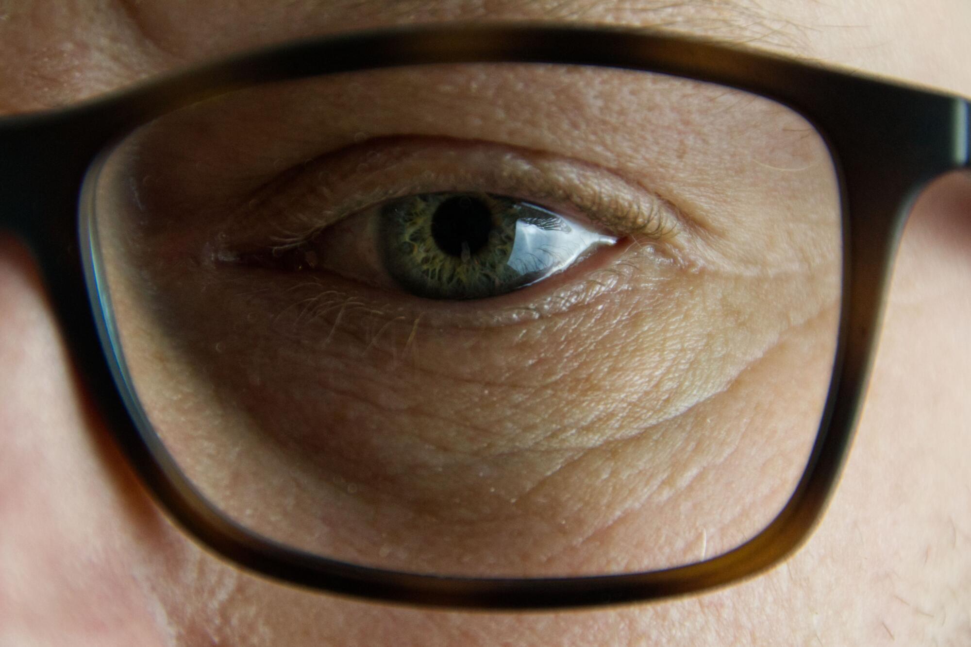 Diabetes and Cataracts: What Albany Seniors Should Know